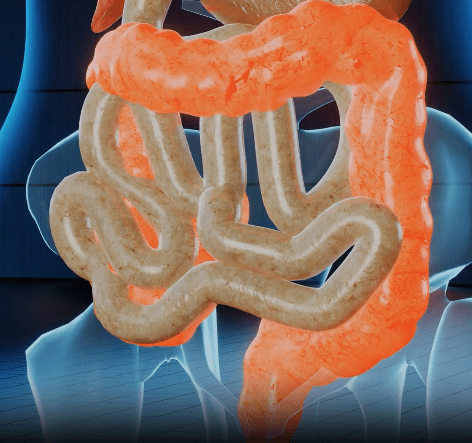 Red Light Therapy and Inflammatory Bowel Disease: A Holistic View