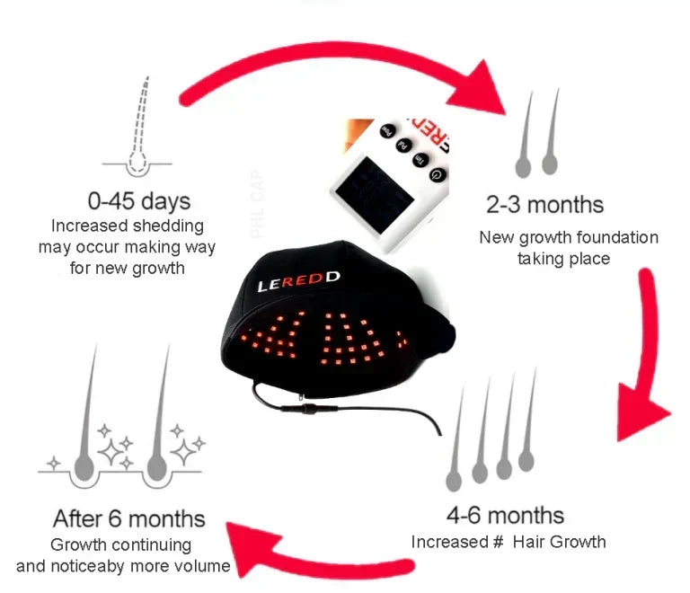 Considering a Hair Transplant in Turkey or Thailand ? Think Again